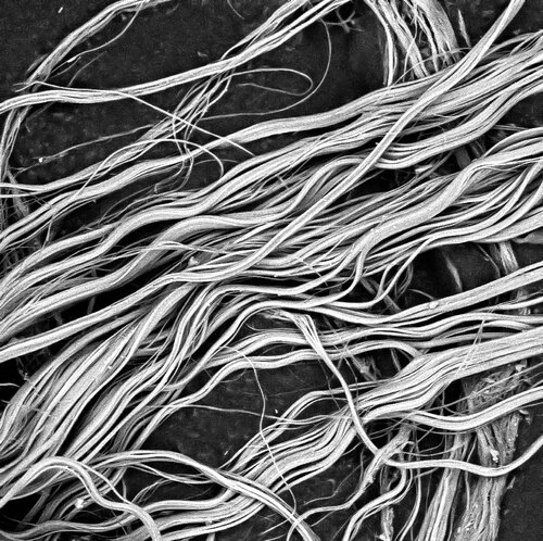 SEM-Magnified Asbestos Fibres from Asbestos Test 