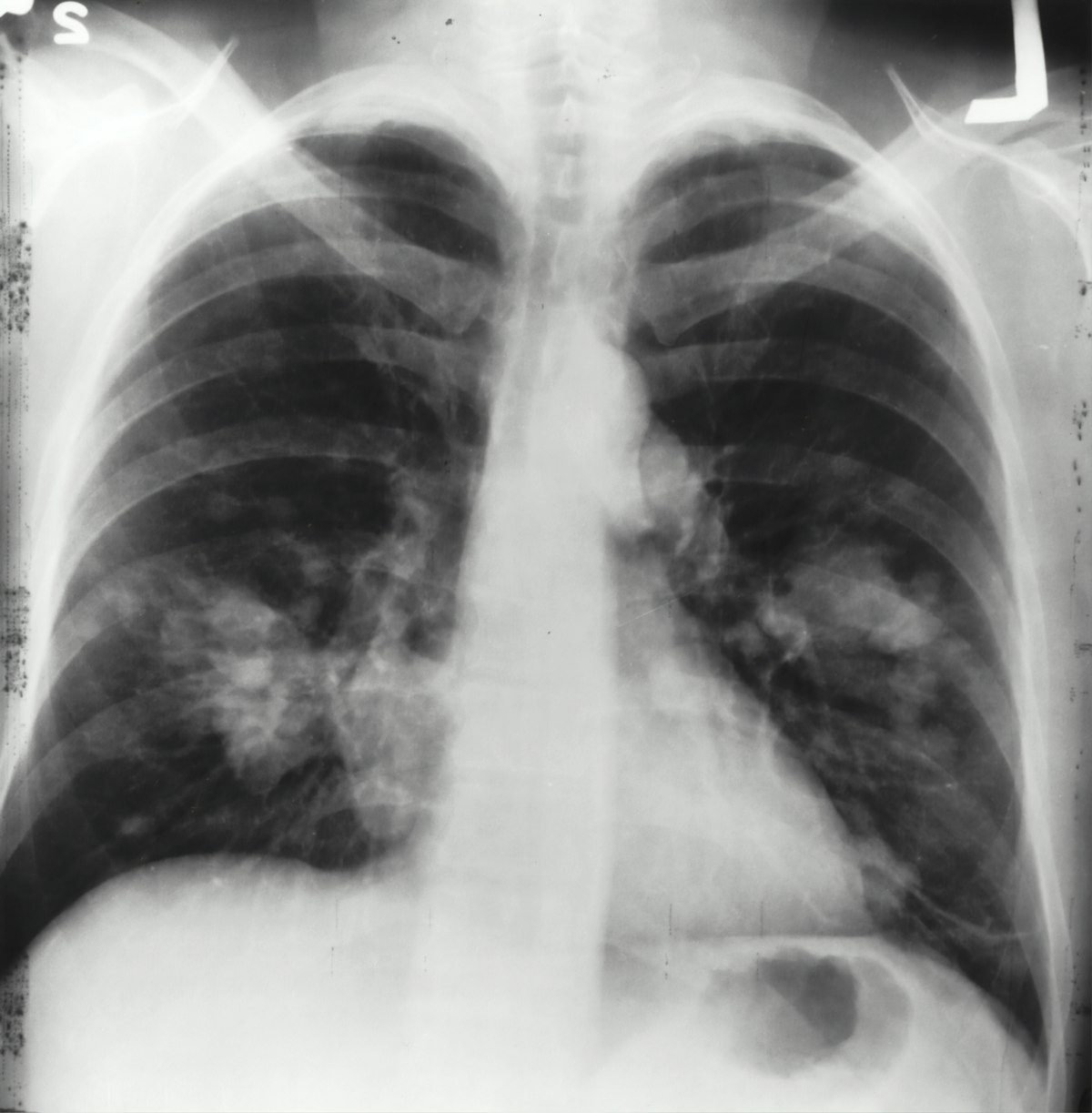 South Australia Government Releases New Plans to Protect Workers, Businesses and the Community Against Crystalline Silica Exposure